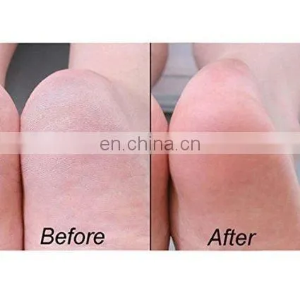 Open Toe Dry Hard Cracked Skin Spa Moisturising Silicone Gel Moisture Heel Socks photo-6