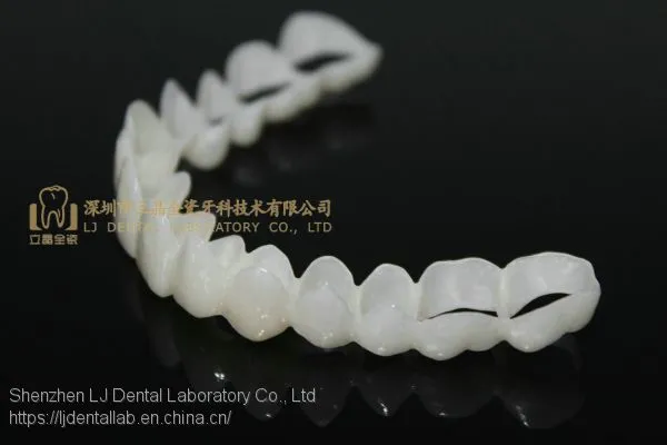 CAD/CAM PMMA Resin Clip on Veneers, Snap-on-veneers, Smile Veneers, Laboratoire Dentaire, Dentallabor, Laboratorio Dental, Dental Laboratory, Shenzhen LJ Dental Lab China photo-5