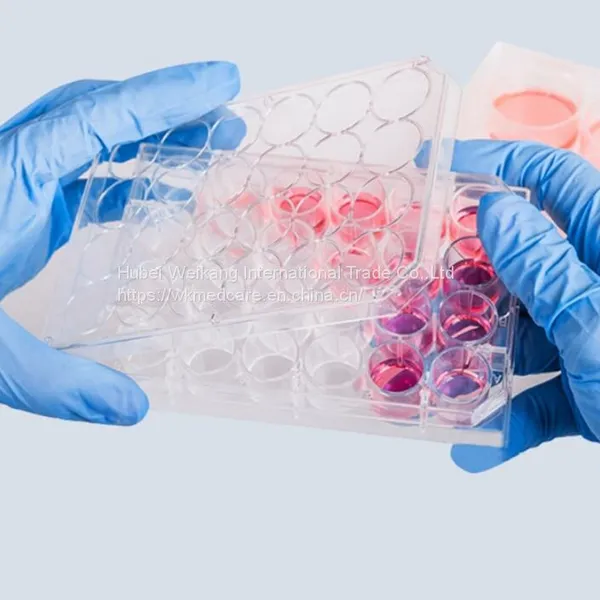 Medical Nitrile Examination Gloves Medical Nitrile Gloves Manufacturer Wholesale Medical Nitrile Gloves