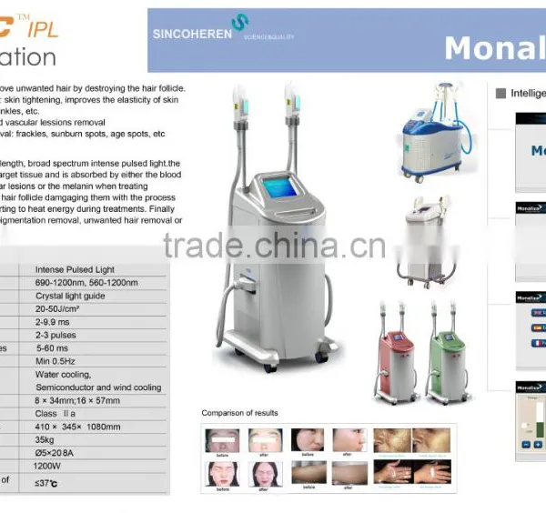 High Quality 2016 Super Laser Cutera Shr Ipl / Ipl Shr Machine photo-2