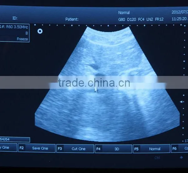 2016 Excellent Quality Big Promotion Digital Portable Diagnostic Ultrasound Scanner/Machine Inside Working Station-RUS-9000A photo-4