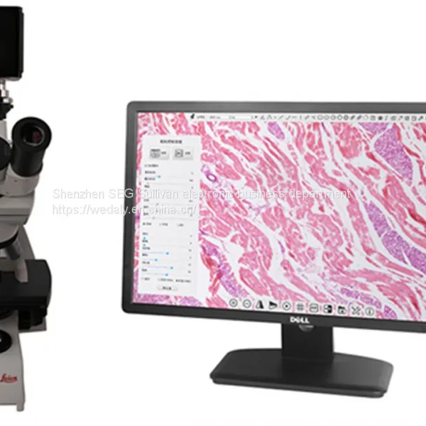 4K/1080P Adaptive Camera Industrial Camera Electron Microscope photo-4