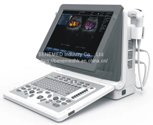 2D Echo Color Doppler Ultrasound Scanner
