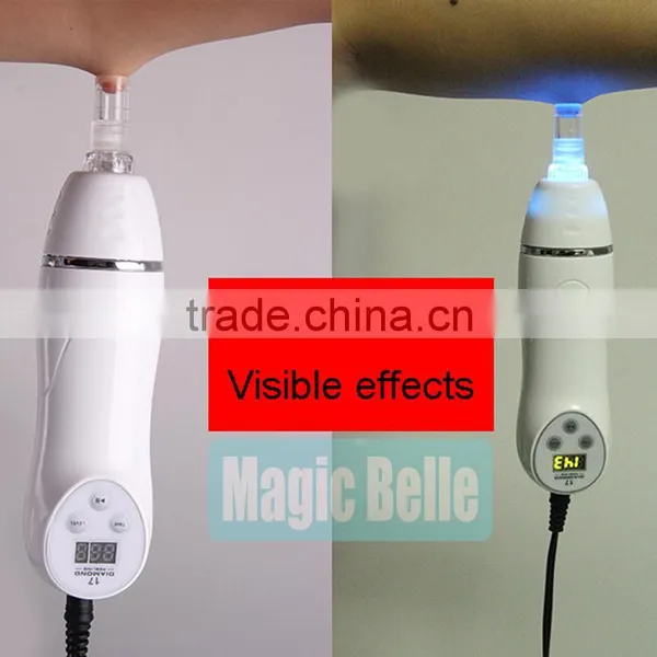 Big Sale Scar Acne Pore Peeling Machine Skin Care Beauty Machine Chinese Blackhead Remover With CE photo-2