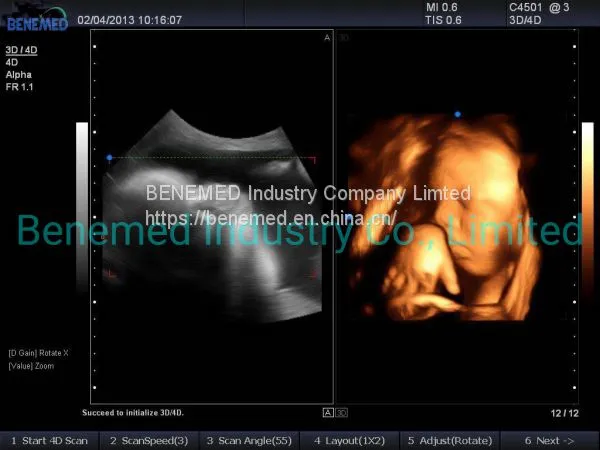Premium 4D Color Doppler Ultrasound Scanner photo-4