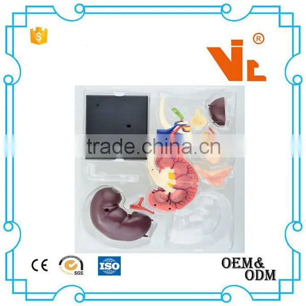 V-HM05 4D MASTER Human Kidney Structure Model photo-4