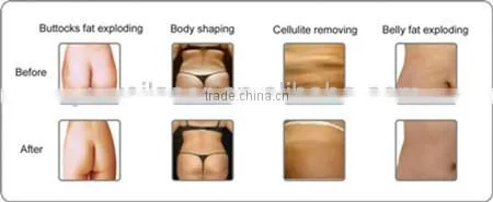 New Products Looking for Distributor! 650nm Lipo Diode Laser Slimming Machine photo-6