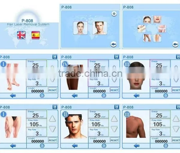 Professional Factory Supply Hair Removal Machine Best Price 808 Diode Laser Hair Removal photo-5