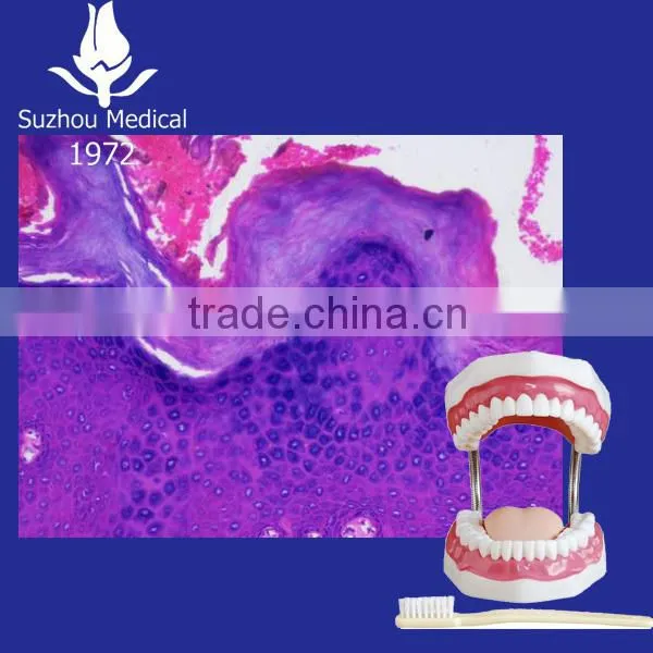 Oral Pathological Prepared Slides