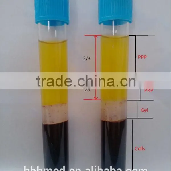 Non-pyrogenic Platelet Rich Plasma Centrifuge Prp Kit photo-3