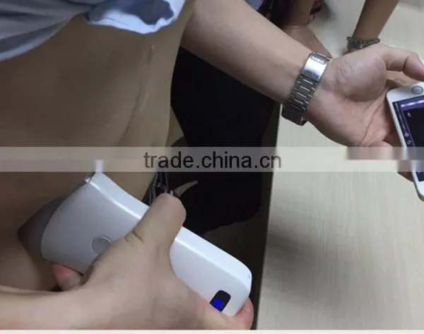 UltraSound Scanner, Convex Probe Ultrasound Scanner, WiFi, 3.5MHz / R40 / 64 Elements, SIFULTRAS-5.1 photo-6