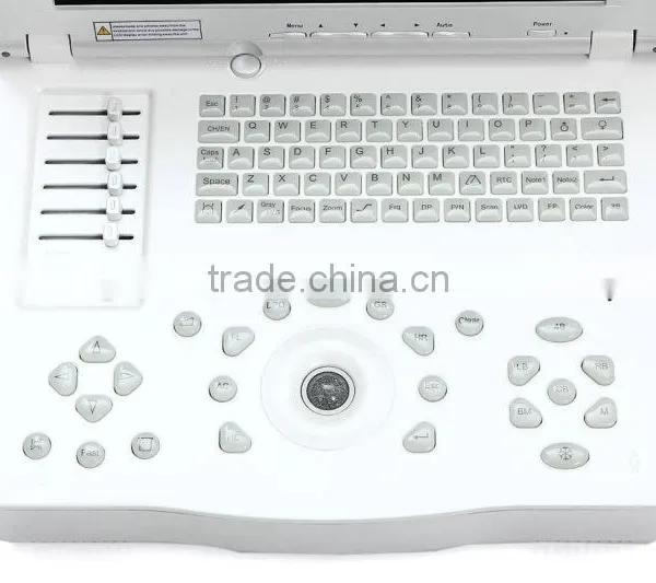 CE&ISO13485&FDA Approved Digital Portable Type 15-inch Laptop Ultrasound Scanner photo-3