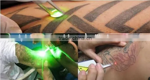 Best Selling Beauty Salon Equipment!!! 2015 Newest Professional Laser Tattoo Removal Machine With CE Approved photo-2