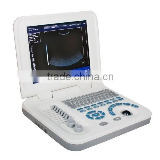 Full Digital Laptop B&W Ultrasound System Ultrasound Scanner Ultrasound Machine photo-2