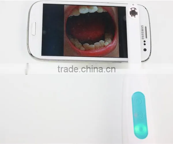 Home Using Detal Came With Wifi 720p Full hd Intra Oral hd Camera photo-4