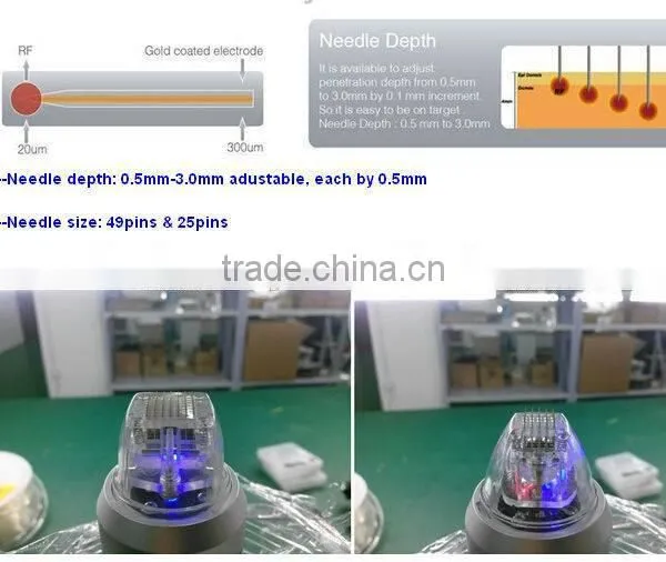 2016 Express Micro Needle rf / Fractional rf Microneedle Sale /radio Frequency Wrinkle Removal and Skin Rejuvenation photo-5