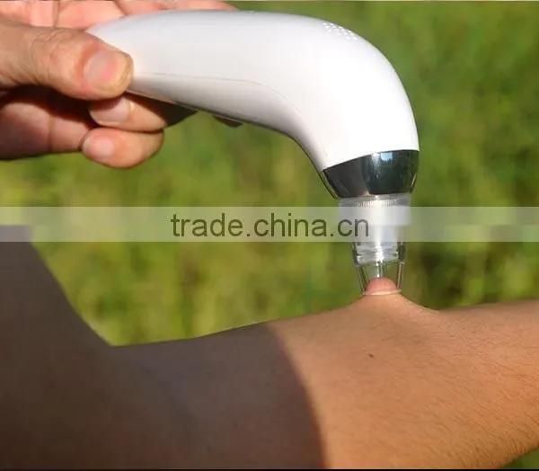 CE Approval Lighten Spots/Facial Skin Lightening Diamond Dermabrasion Machine From China photo-6