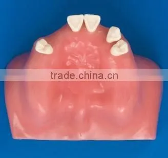 Factory Price Clinical Drill Model Cableway/ Dental Implant Model/implantes for Teeth photo-2