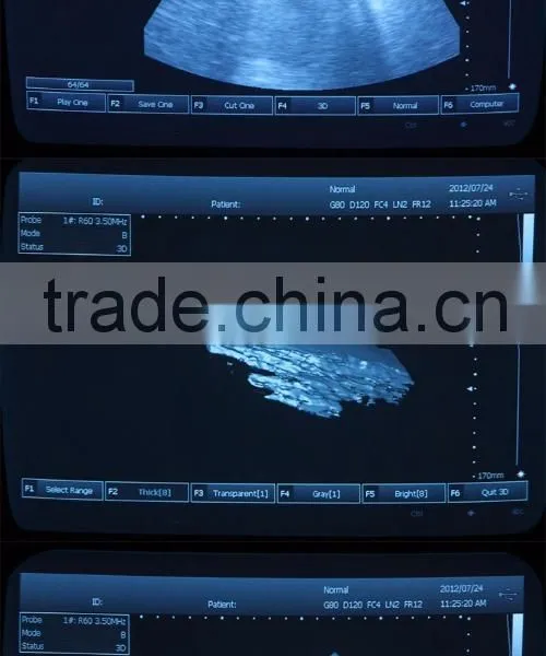 China Portable Medical Gynecology 10 Inch Ultrasound Machine / Equipment Price photo-5