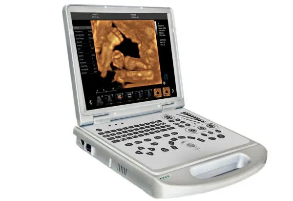 4D Baby Portable Medical Color Doppler Ultrasound Machine