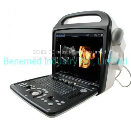 Premium 4D Color Doppler Ultrasound Scanner photo-2