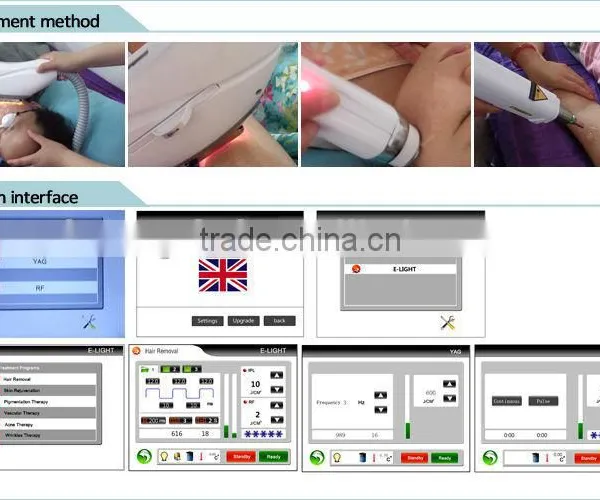 Permanent Ipl Hair Removal photo-5