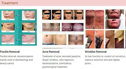Personal Care PDT LED Skin Rejuvenation Device photo-5