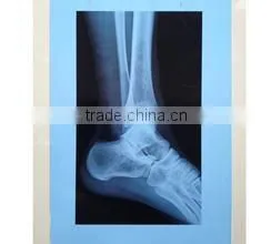 Dry Film X-ray Film Blue Medical Film China Film photo-4