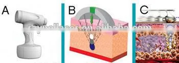 2016 Trending Cellulite Removal Liposuction Cavitation For Sale photo-2