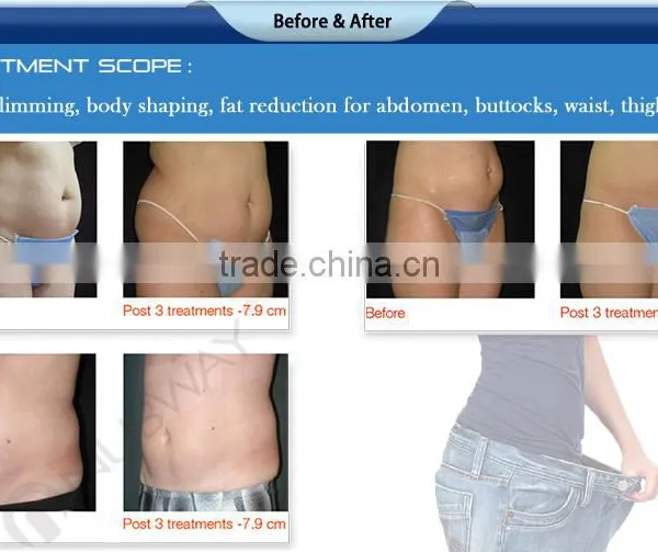 5 In 1 Cavitation Machine Beauty Equipment 1-10 Continuously Adjustable Cavitation Slimming Machine Ultrasonic Ultralift Hifu Skin Lifting photo-5
