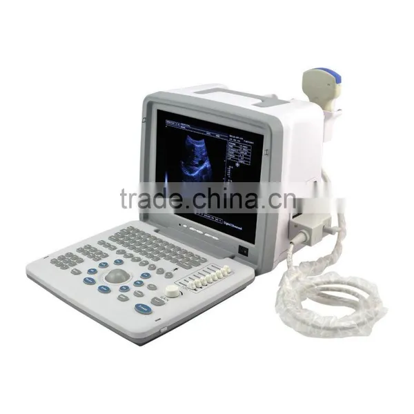 High Performance Low Price Portable Mini Ultrasound Machine for Sale photo-3