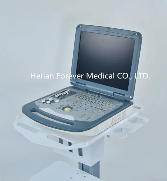 Portable Ultrasound Color Doppler Gynaecology Ultrasound photo-4
