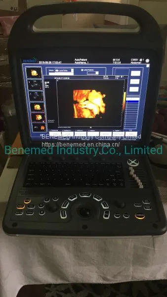 Premium 4D Color Doppler Ultrasound Scanner photo-3