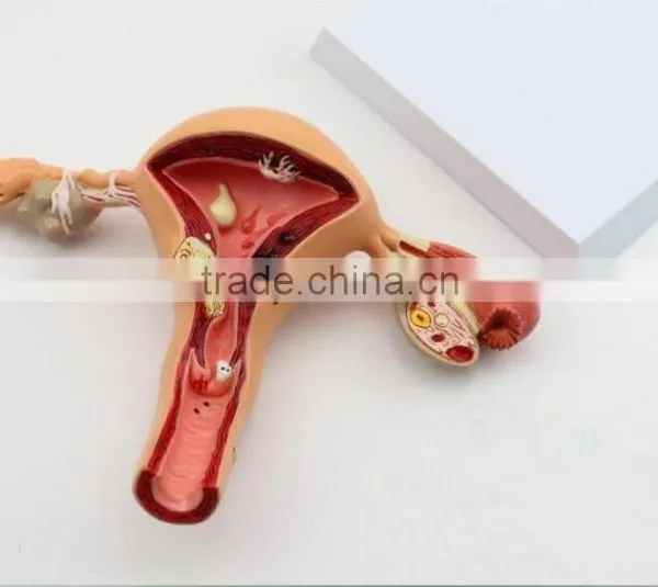 Human Uterus and Ovary Vaginal Pathological Changes Model of Reproductive Department of Gynecology Medical Demonstration Model photo-5