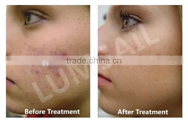 CE Approval PDT LED Phototherapy Skin Lightening Beauty Personal Care Beauty System photo-3