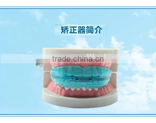 TOP Blue Tooth Orthodontic Alignment Trainer photo-4