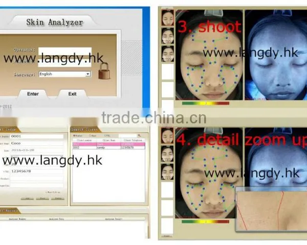 Auto Facial Skin Portable Analyzer With Customer Datebase and 10 Mega Pixels Camera photo-3