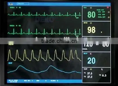 Medical Monitor photo-4