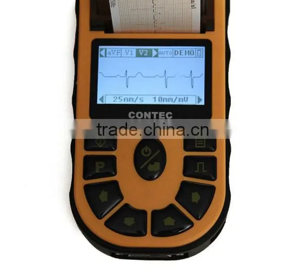 CE&ISO Price Single Channel Palm Handheld Human Use Electrocardiograph ECG Machine EKG Machine Price With Software and Printer photo-5