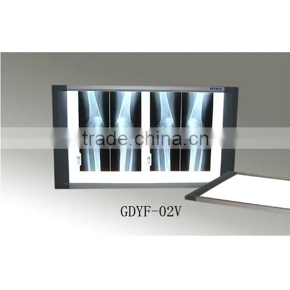 X-ray Film Viewer