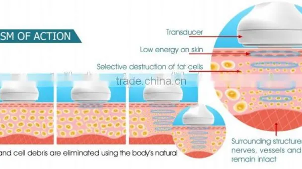 Professional High Intensity Focused Ultrasound Therapy Beauty Machine Weight Loss Machine Fat Burning Instrument photo-4