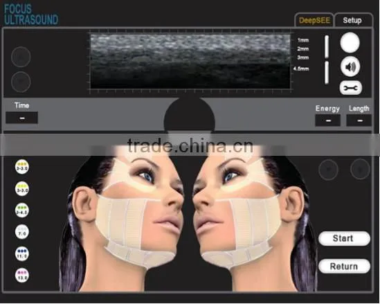 2016 New Promotion High Intensity Focused Ultrasound Eyes Wrinkle Removal Hifu Machine/ 2016 Hifu Deep Wrinkle Removal photo-2