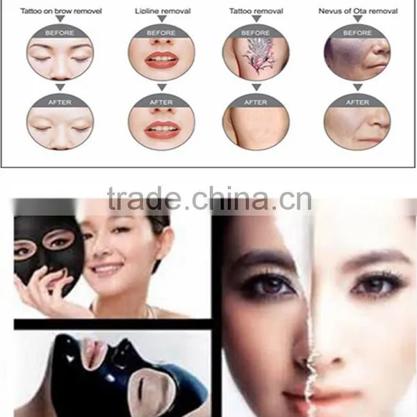 Varicose Veins Treatment Beauty Equipment Yag Laser Facial Veins Treatment Tattoo Removal Machine Price 1064nm photo-4
