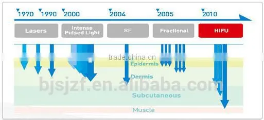HIFU-C Trending Hot Products High Intensity Ultrasound Cryo Lifting Face/hifu Lifting Big Promotion photo-2