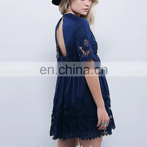 High Quality Short Sleeve Back Open Lace Dress, Tee Lace Dress photo-4