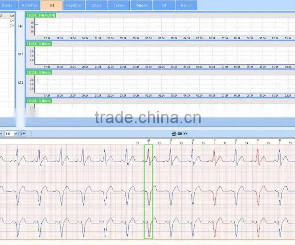 CE Approved 12 Channel Mini 24/48-hour LCD ECG Holter Recorder System With Premier Holter Software-ECGLAB photo-5