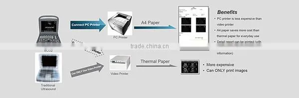 ECO2 High Image Quality Good Price Black and White Portable Ultrasound Chison photo-5