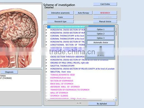 Quantum Health Analyzer Auto Full Body Health Analyzer 9D Full Body Analyzer photo-4