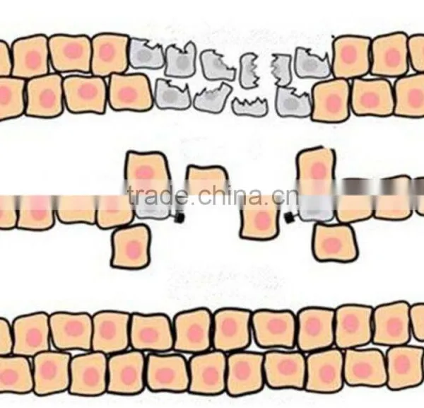For Skin Resurfacing, Vaginal Tightening rf Fractional Co2 Laser photo-5