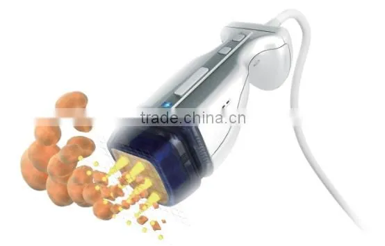 HIFU Fast Slimming !!! Factory Price Hifu Ultrashape Want Distrobutor photo-3